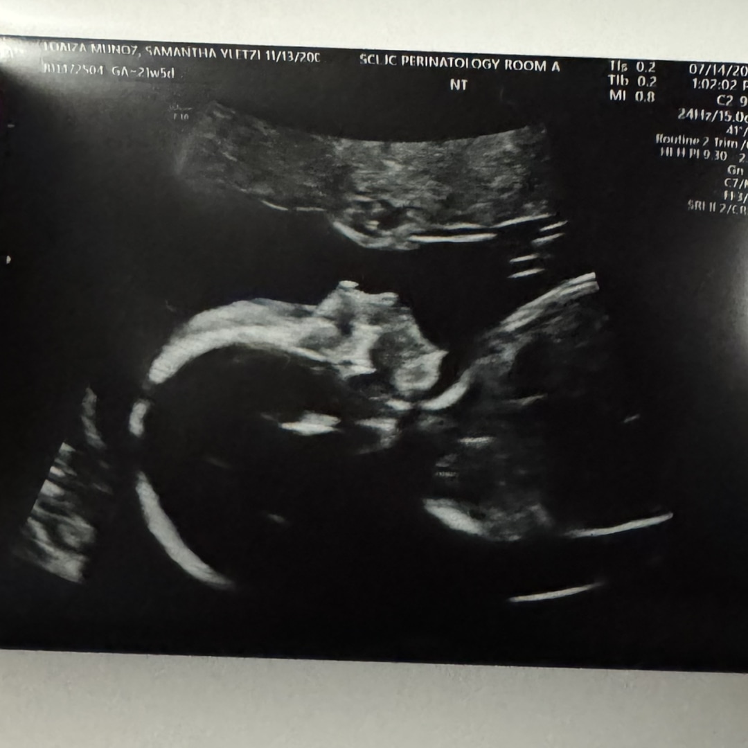 Photo shared by Samantha for their Babylist baby registry.