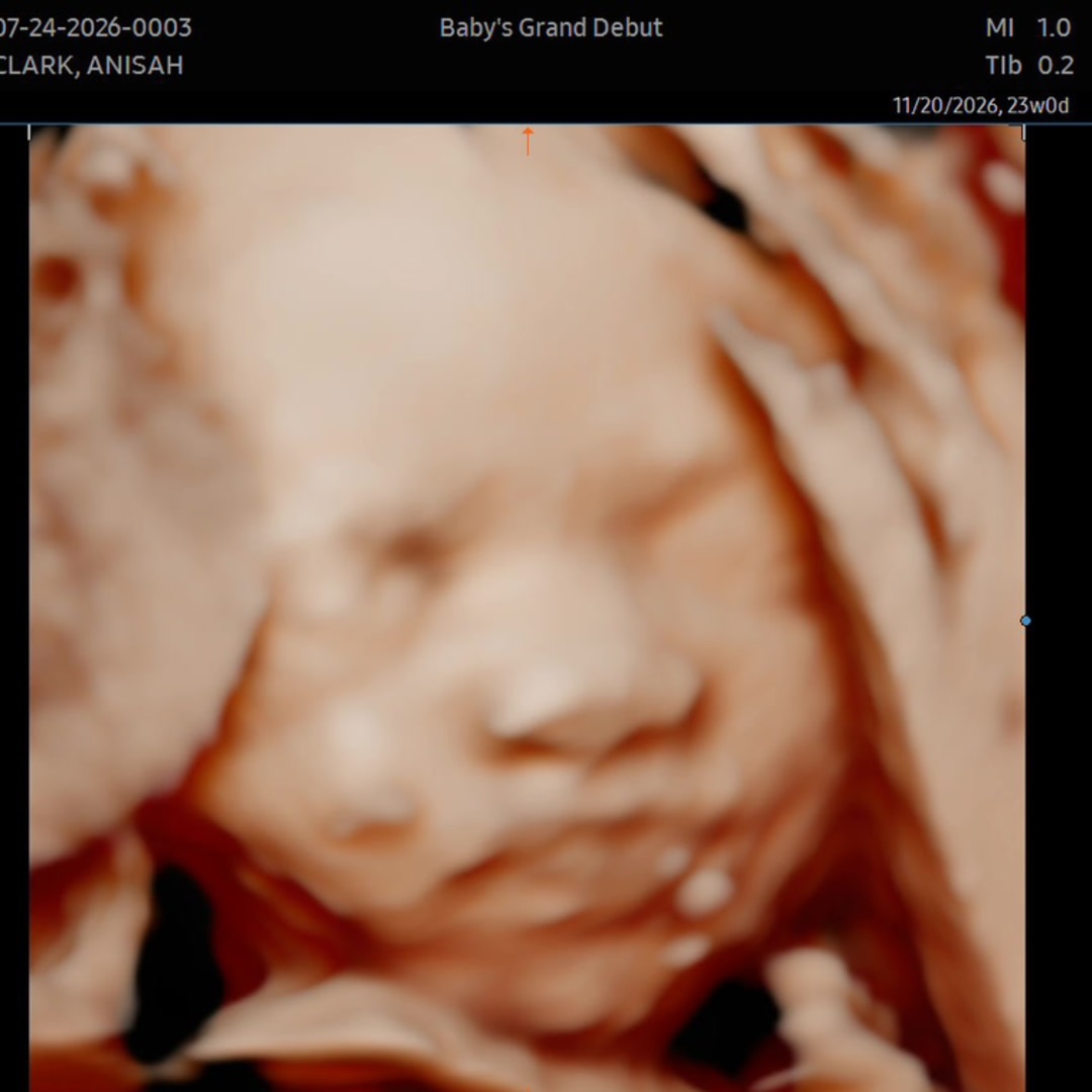 Photo shared by Anisah-Nina for their Babylist baby registry.