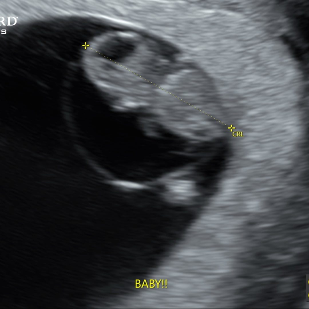 Photo shared by Ashley for their Babylist baby registry.
