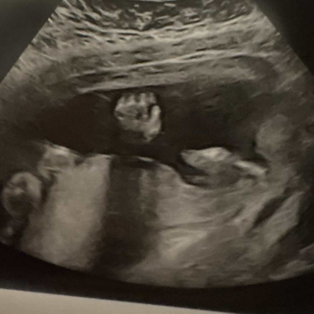 Photo shared by Alie for their Babylist baby registry.