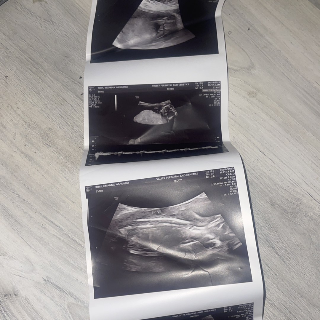 Photo shared by Kay Kay for their Babylist baby registry.
