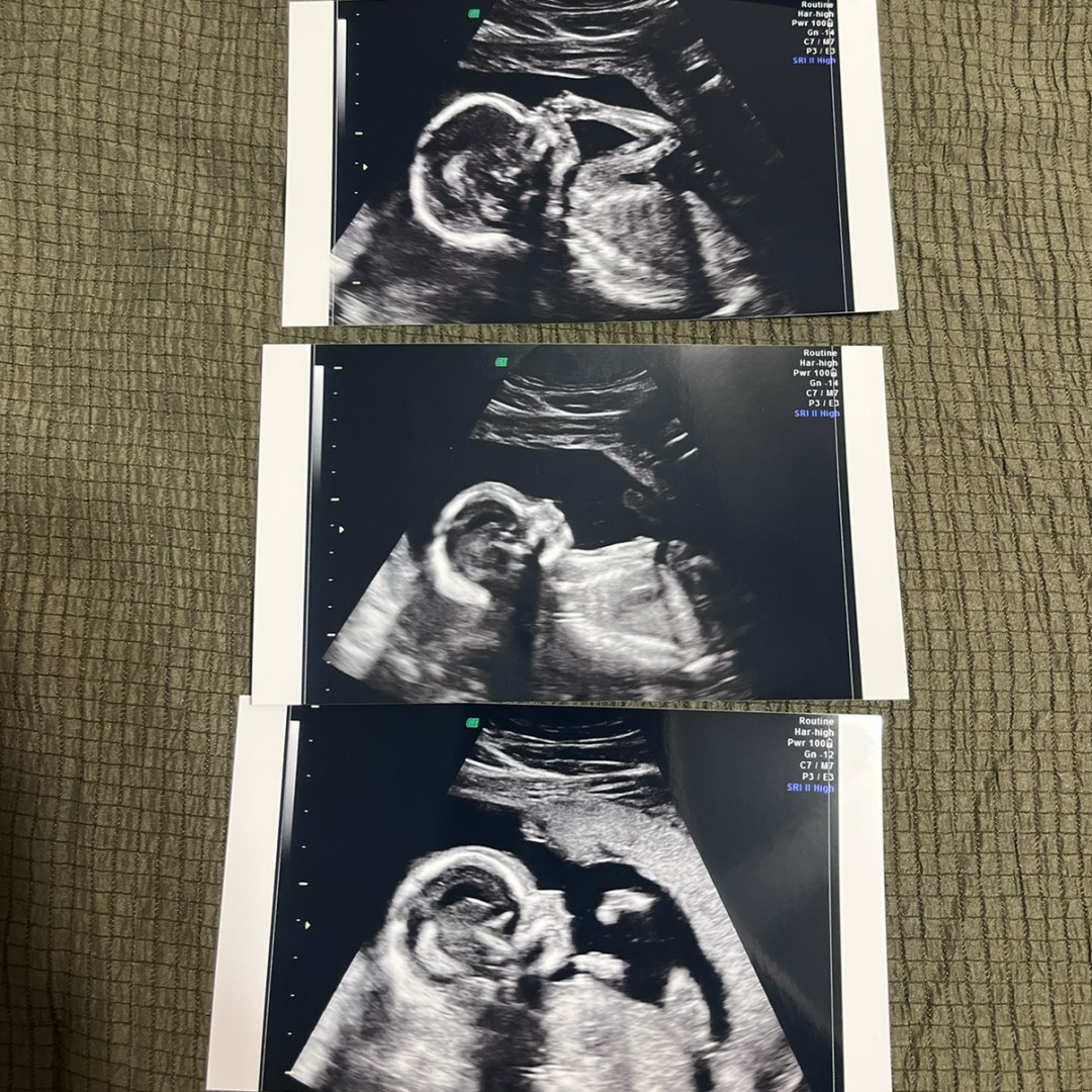 Photo shared by Faith for their Babylist baby registry.