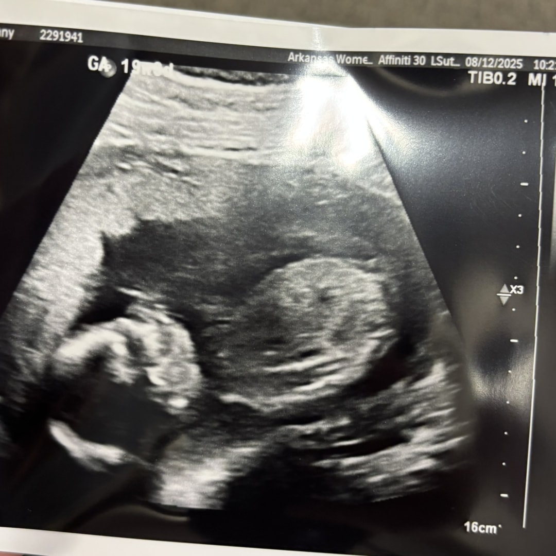 Photo shared by Bethany for their Babylist baby registry.