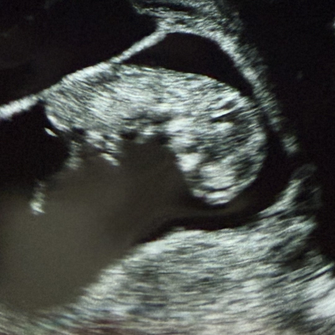 Photo shared by Nikki for their Babylist baby registry.