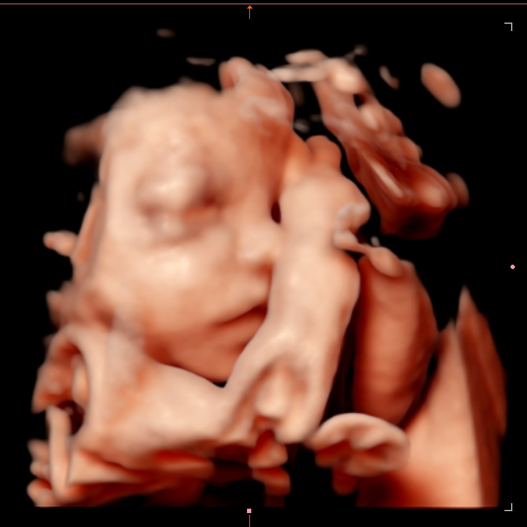 Photo shared by Amanda for their Babylist baby registry.