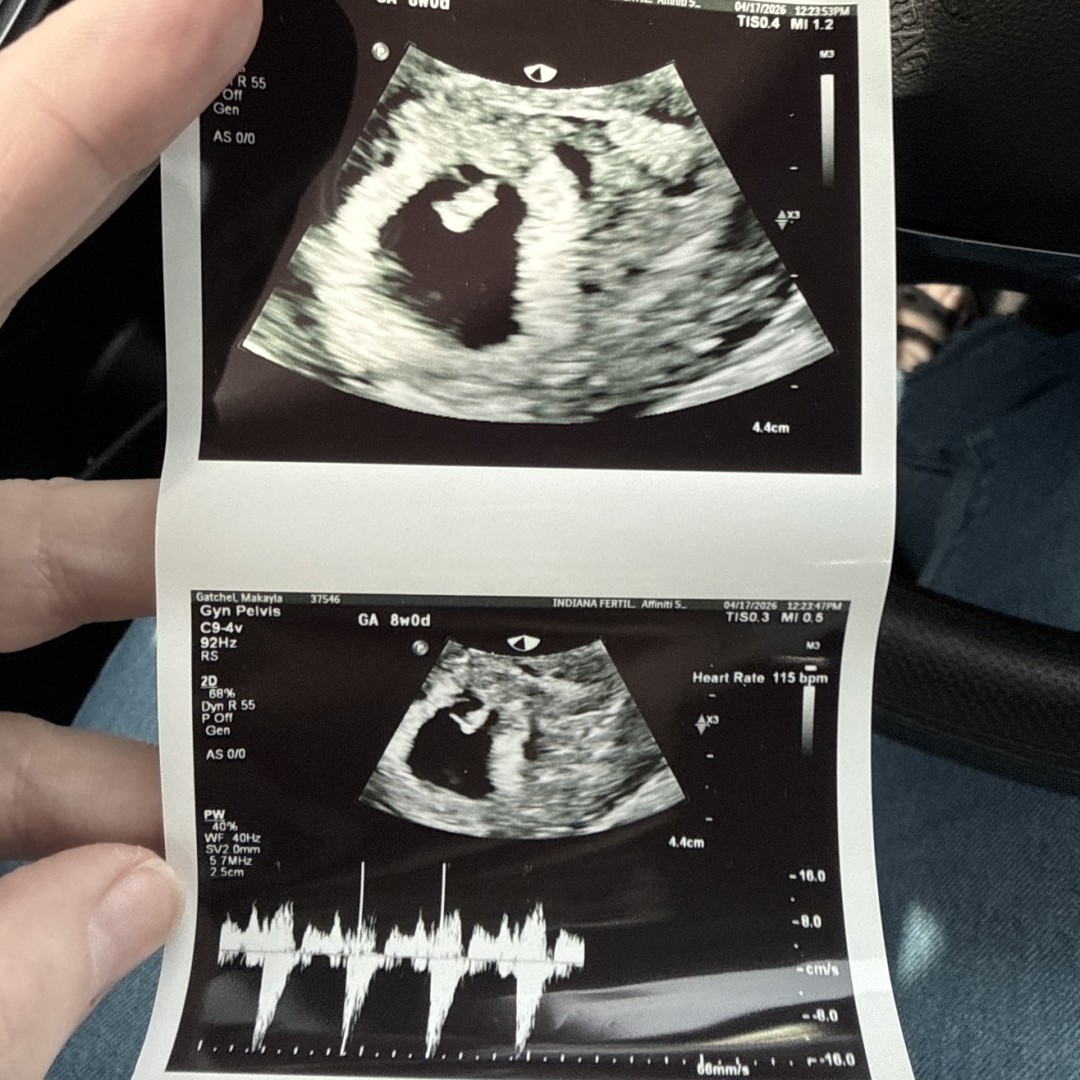 Photo shared by Makayla for their Babylist baby registry.
