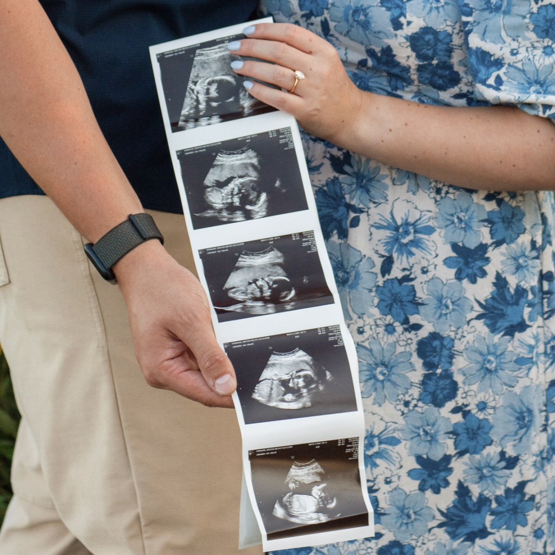 Photo shared by Kristen for their Babylist baby registry.