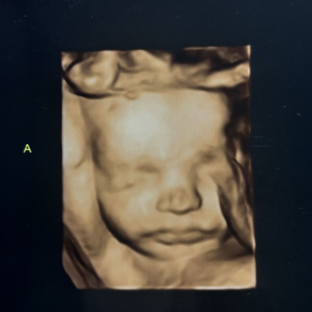 Photo shared by Hannah for their Babylist baby registry.