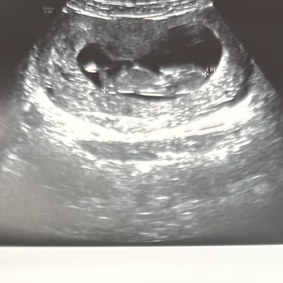 Photo shared by Ariana for their Babylist baby registry.