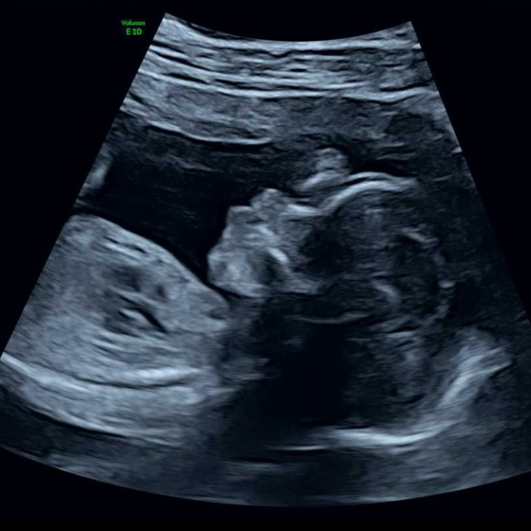 Photo shared by Genesis for their Babylist baby registry.