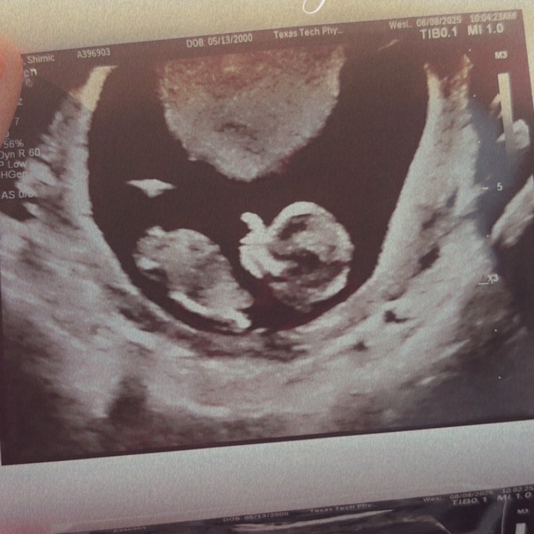 Photo shared by Shimic for their Babylist baby registry.