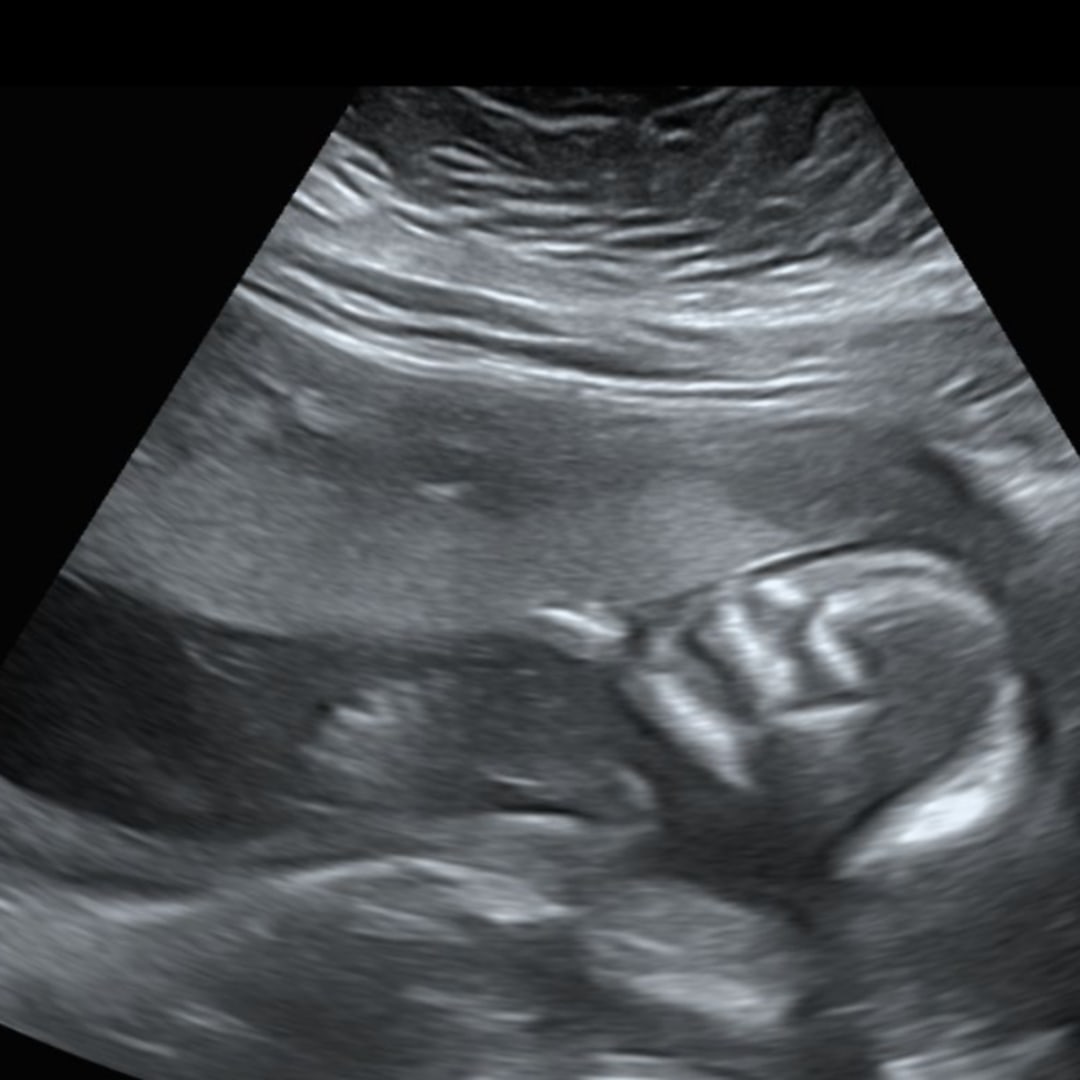 Photo shared by Katelyn for their Babylist baby registry.