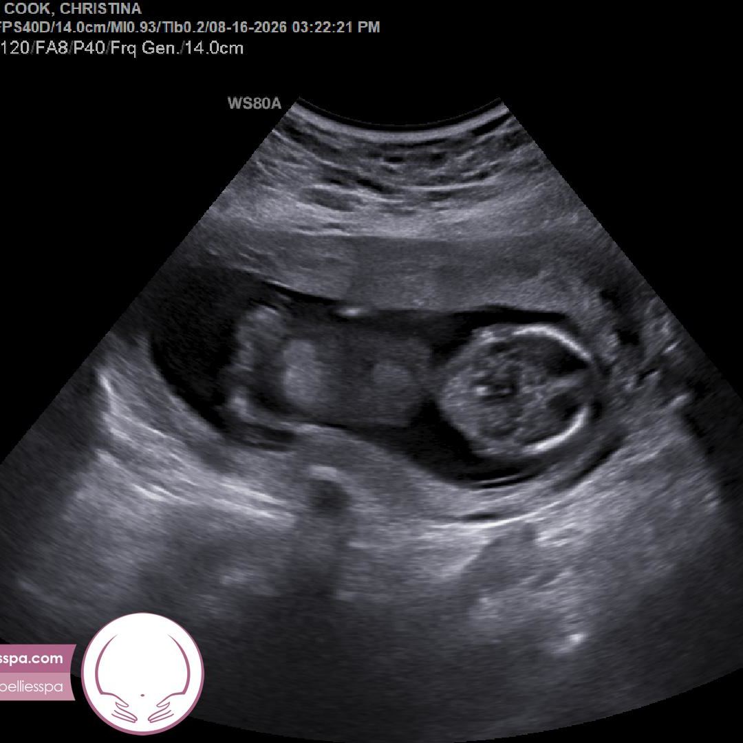 Photo shared by Kris for their Babylist baby registry.