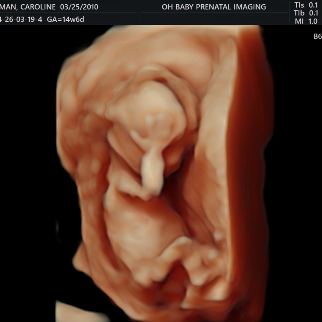 Photo shared by Caroline for their Babylist baby registry.