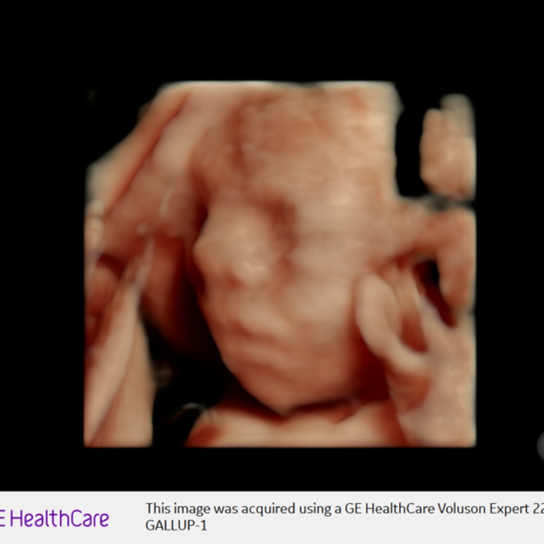 Photo shared by Faith for their Babylist baby registry.