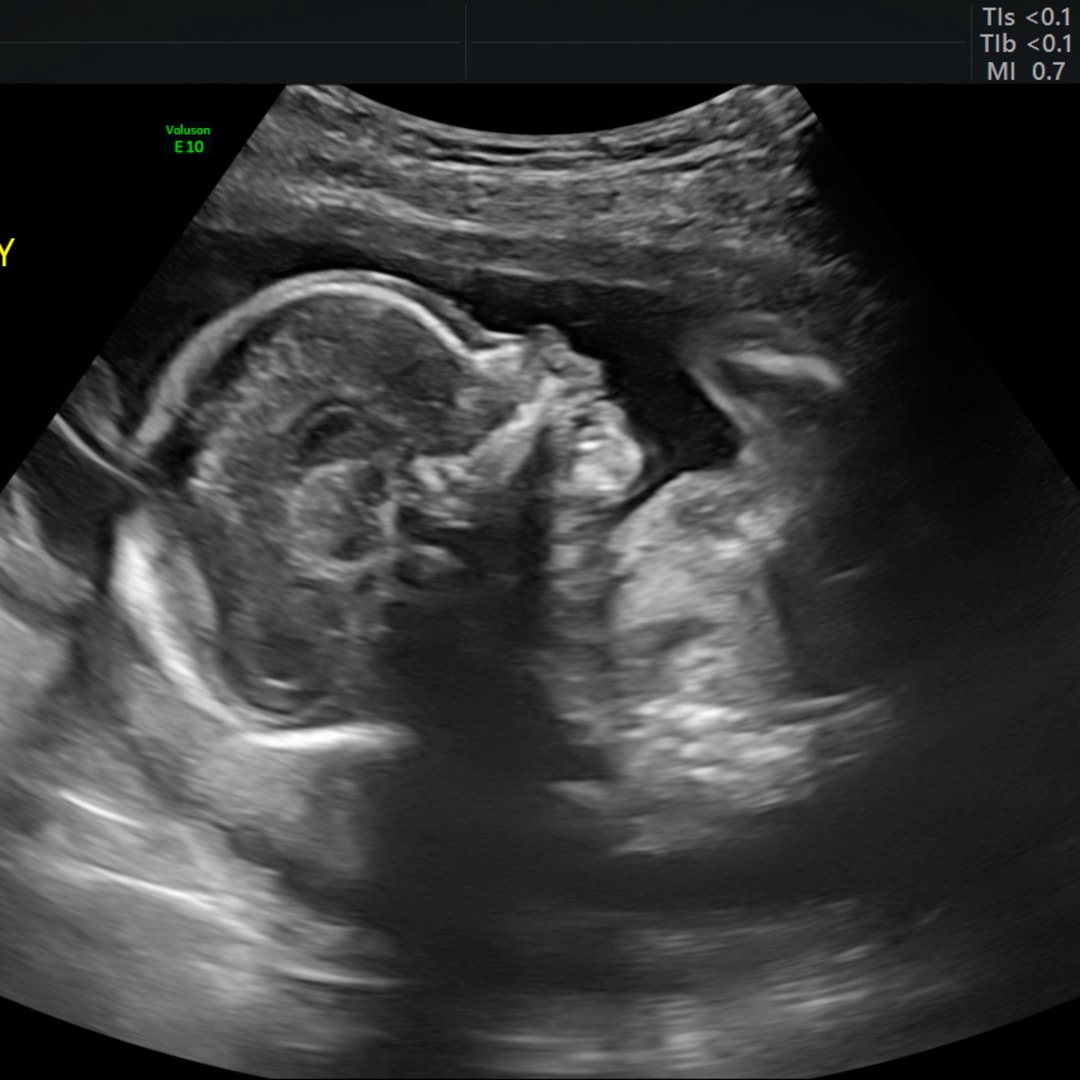 Photo shared by Caroline for their Babylist baby registry.