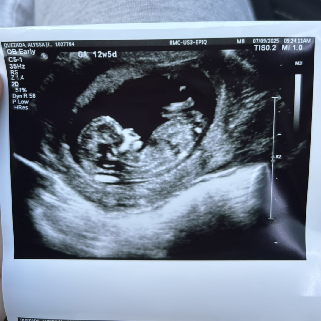 Photo shared by Alyssa for their Babylist baby registry.