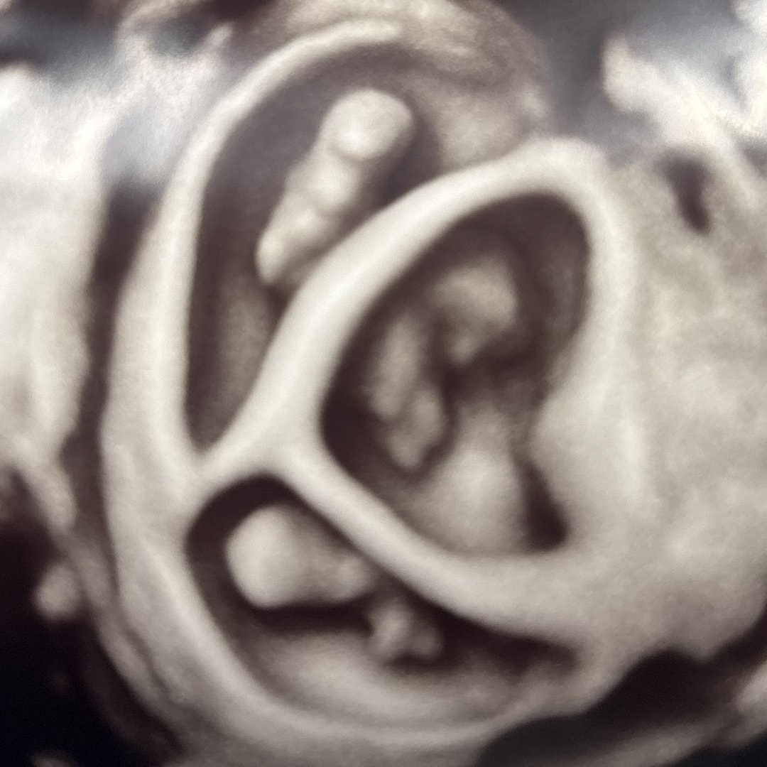 Photo shared by Jaleesa for their Babylist baby registry.