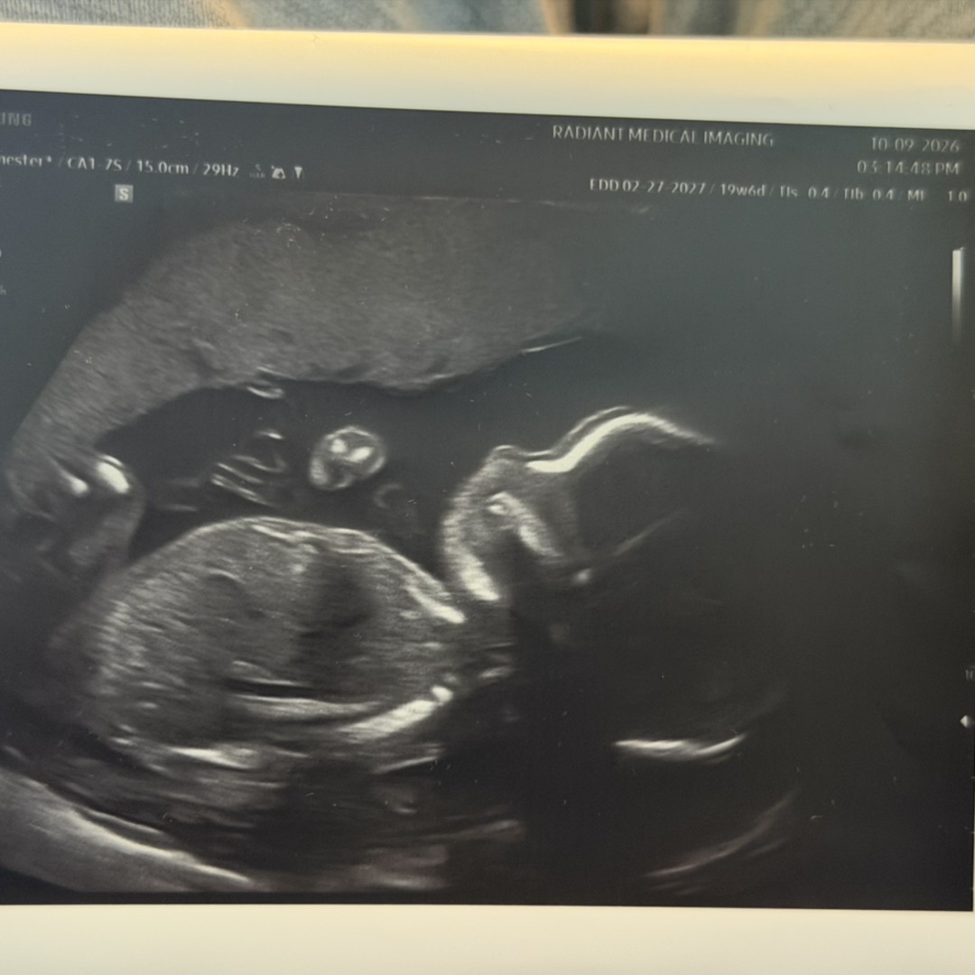 Photo shared by Autumn for their Babylist baby registry.