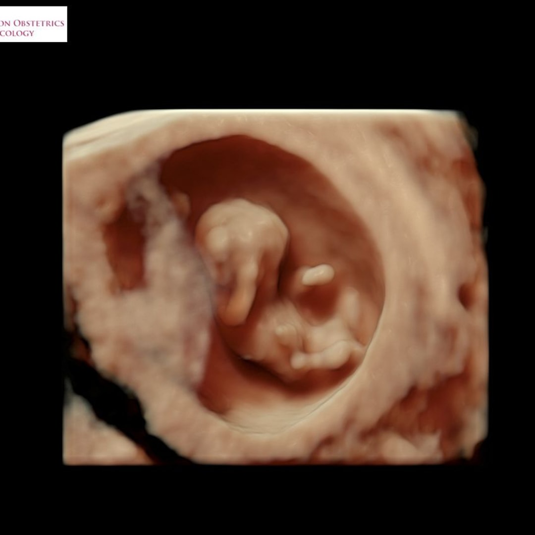 Photo shared by Aviana for their Babylist baby registry.