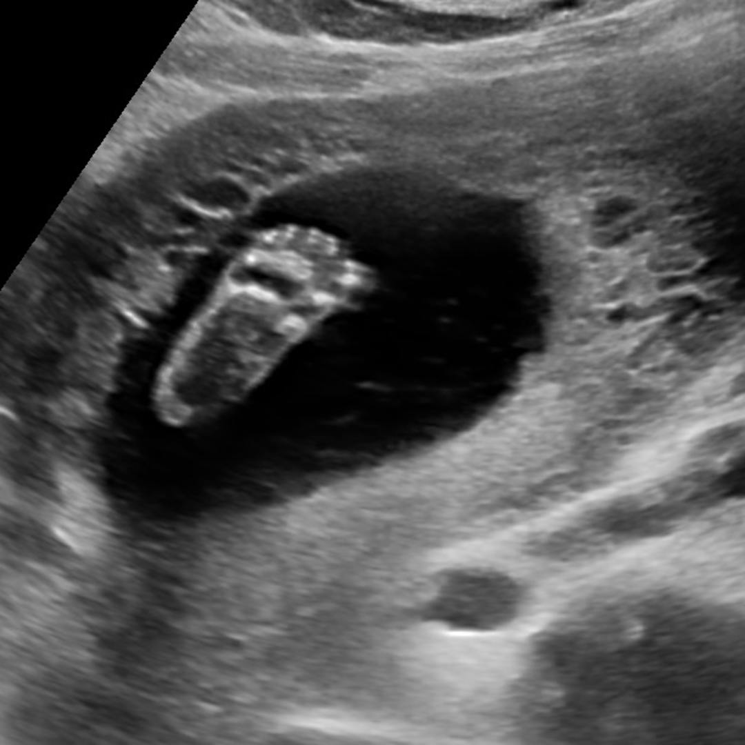 Photo shared by Grace for their Babylist baby registry.