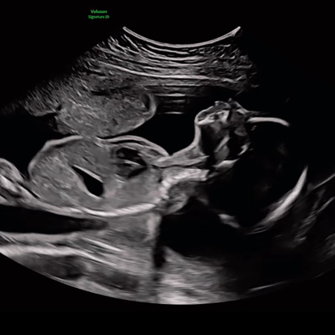 Photo shared by Emily for their Babylist baby registry.