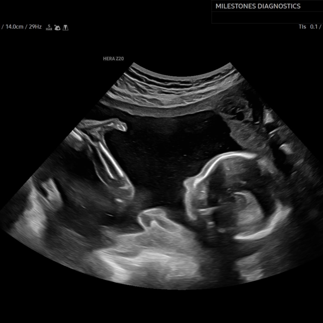 Photo shared by Charlotte for their Babylist baby registry.