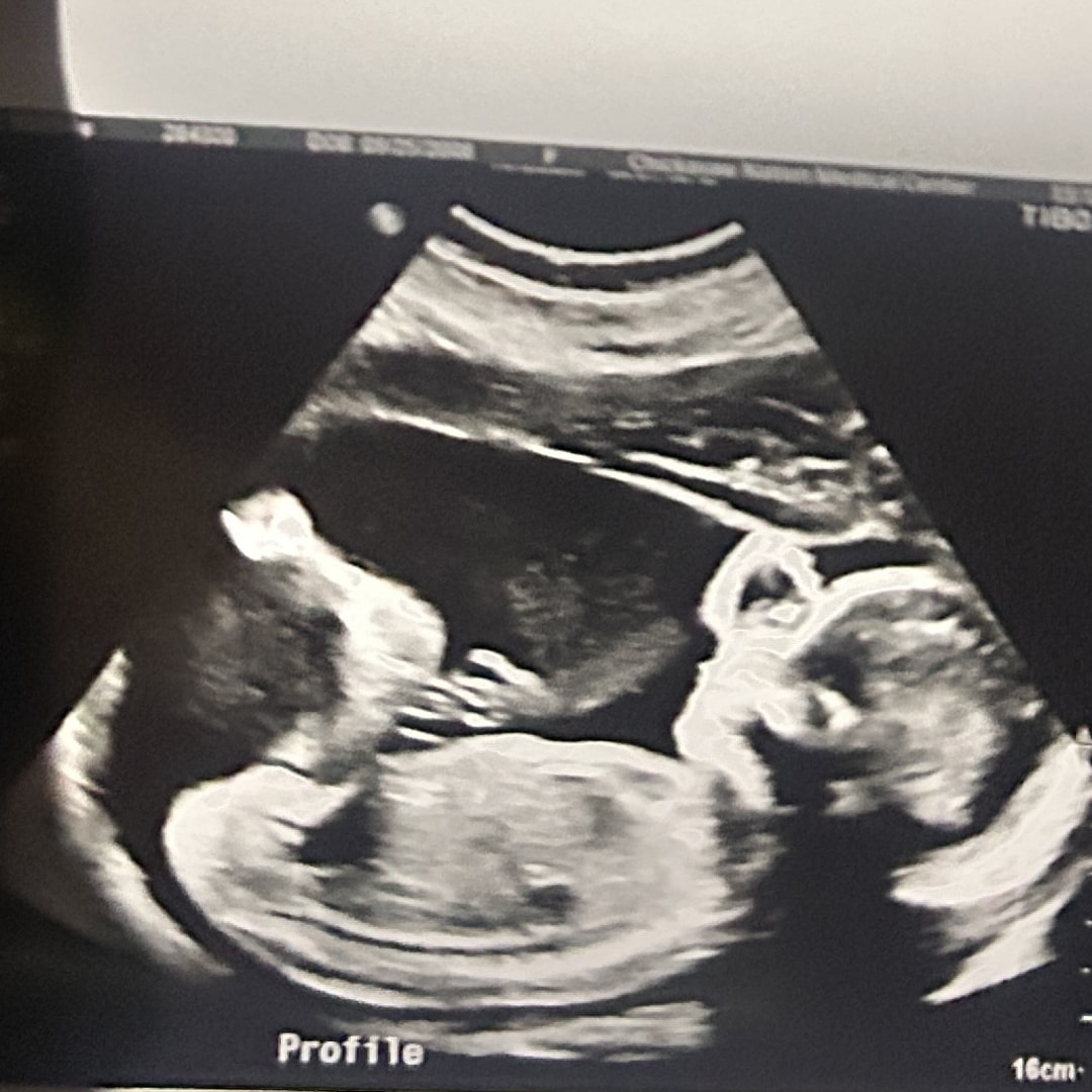 Photo shared by Marielle for their Babylist baby registry.