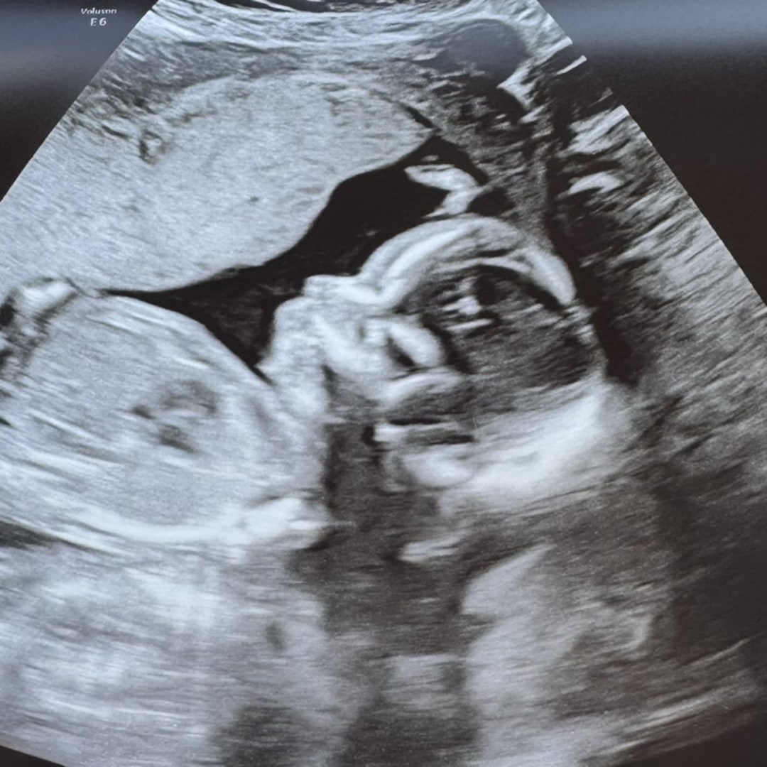 Photo shared by Annabel for their Babylist baby registry.