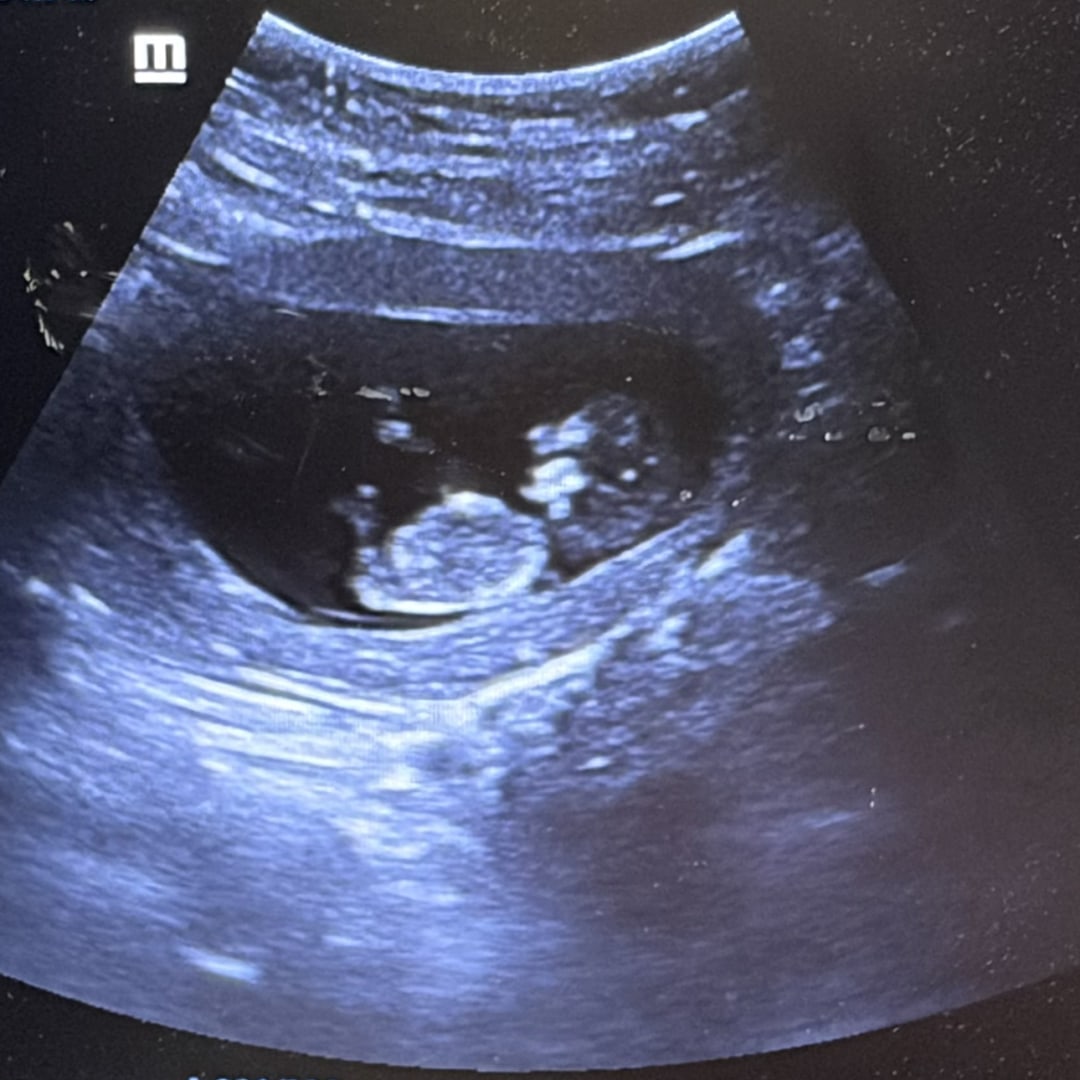 Photo shared by Jannatul for their Babylist baby registry.