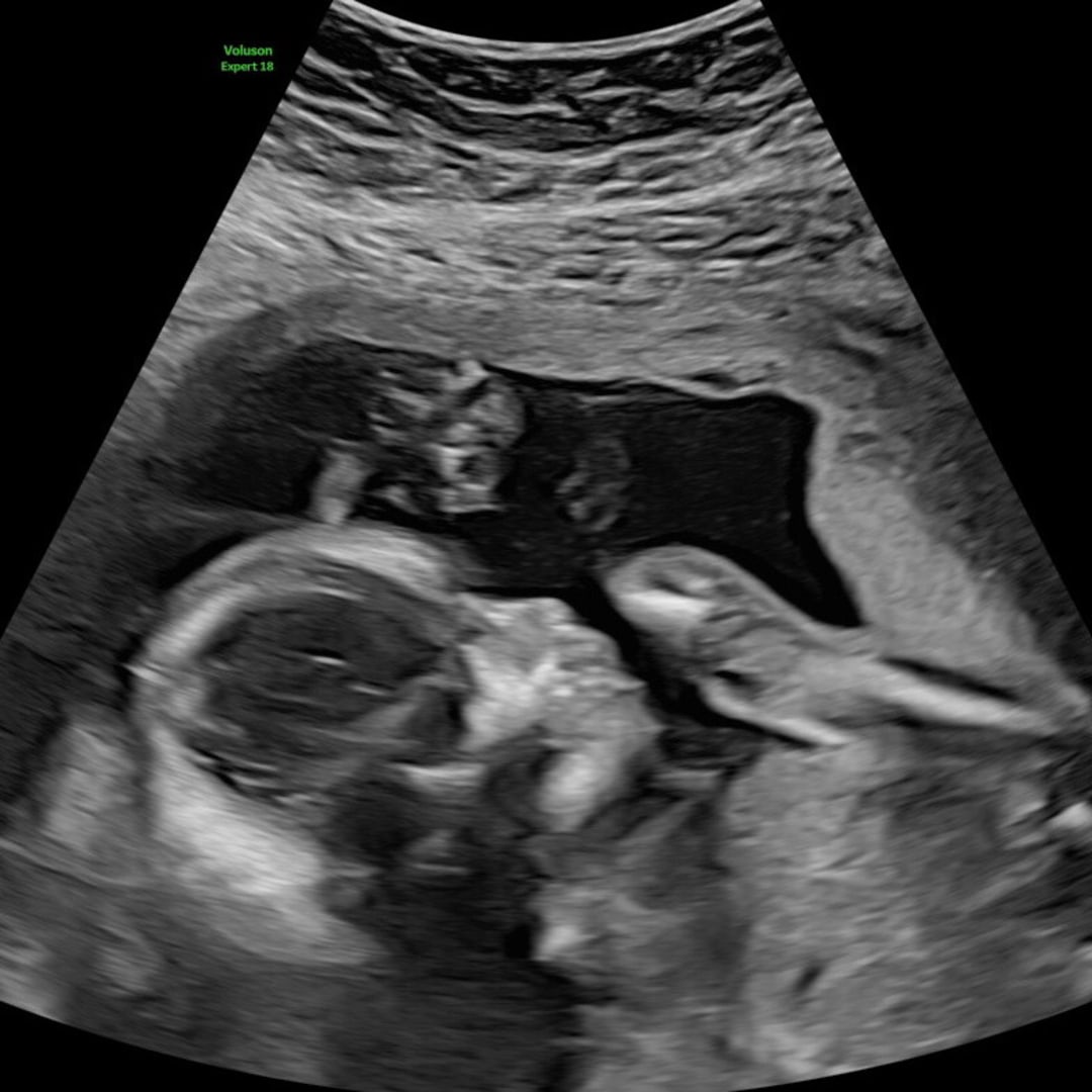 Photo shared by Beka for their Babylist baby registry.