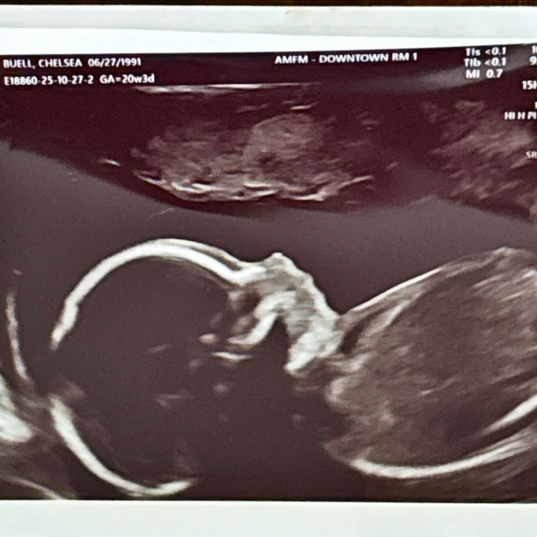 Photo shared by Chelsea for their Babylist baby registry.