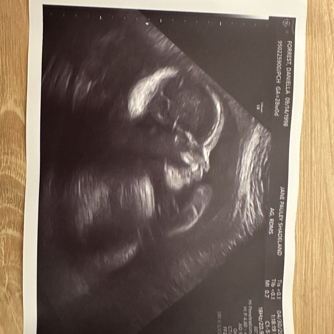 Photo shared by Daniella for their Babylist baby registry.