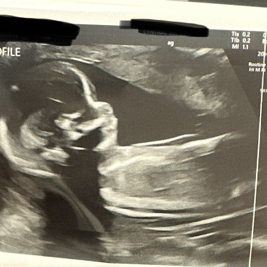 Photo shared by Shakari for their Babylist baby registry.