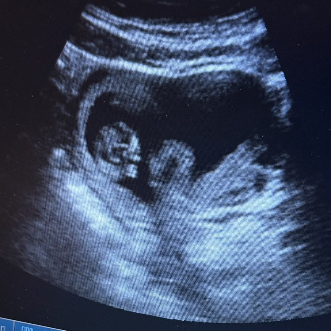 Photo shared by Ana for their Babylist baby registry.