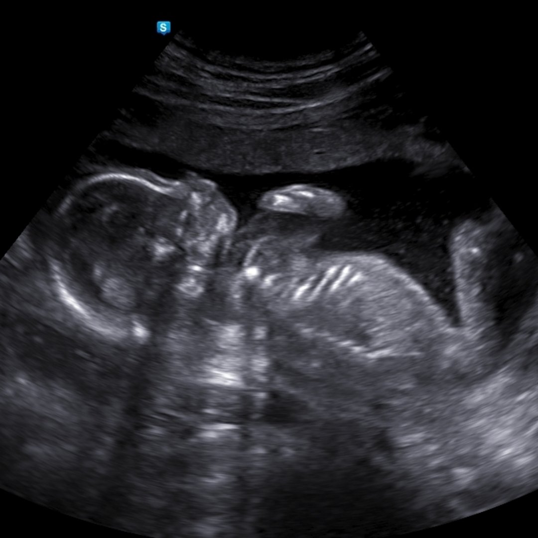 Photo shared by Alivia for their Babylist baby registry.