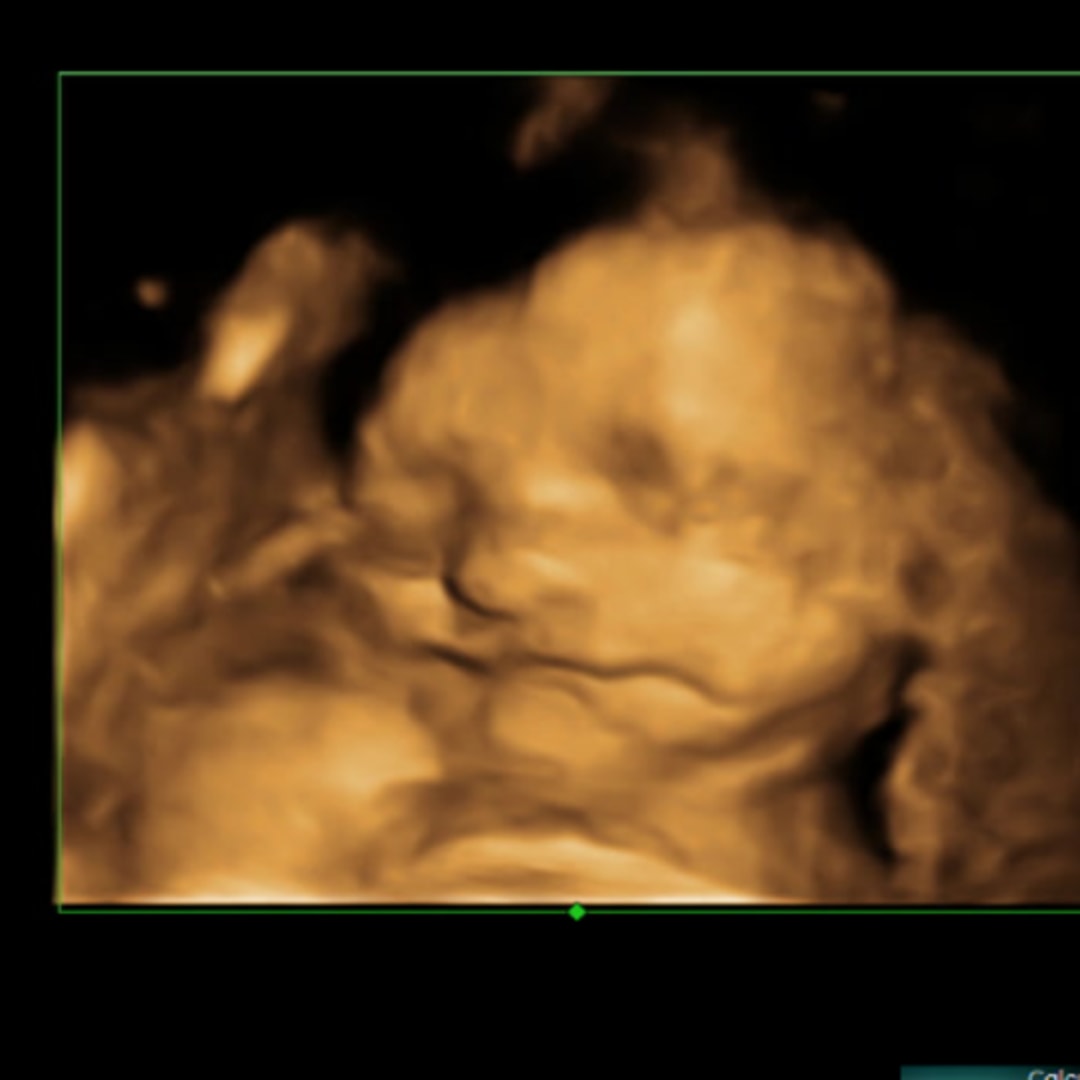 Photo shared by Brinlee for their Babylist baby registry.