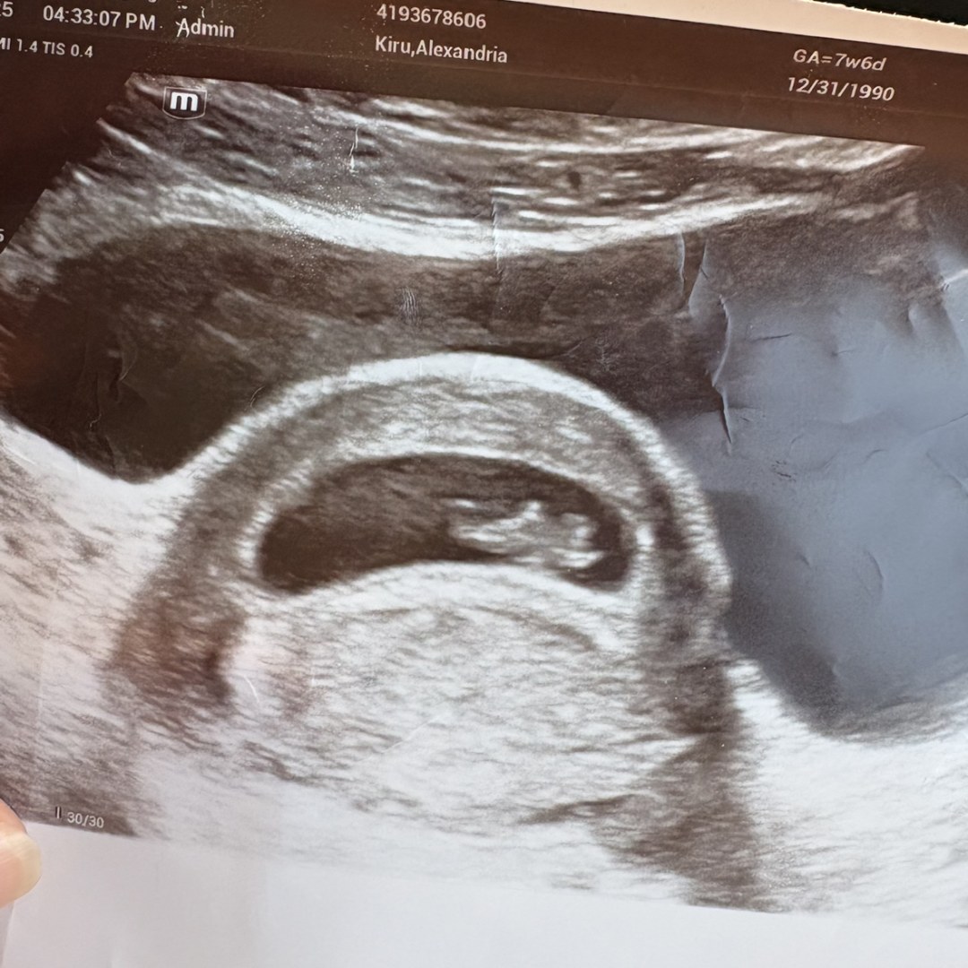 Photo shared by Alex for their Babylist baby registry.