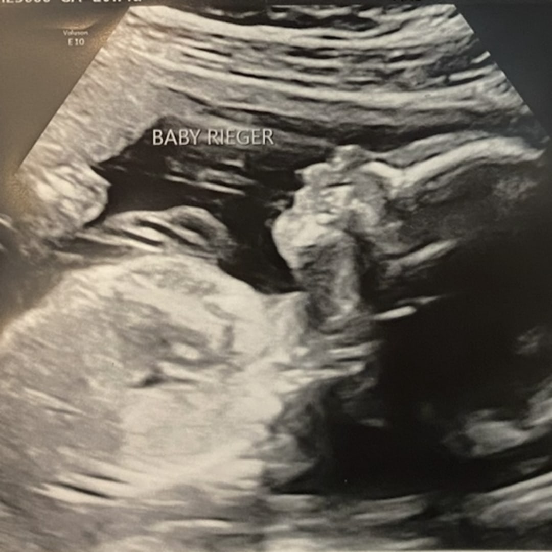 Photo shared by Emily for their Babylist baby registry.