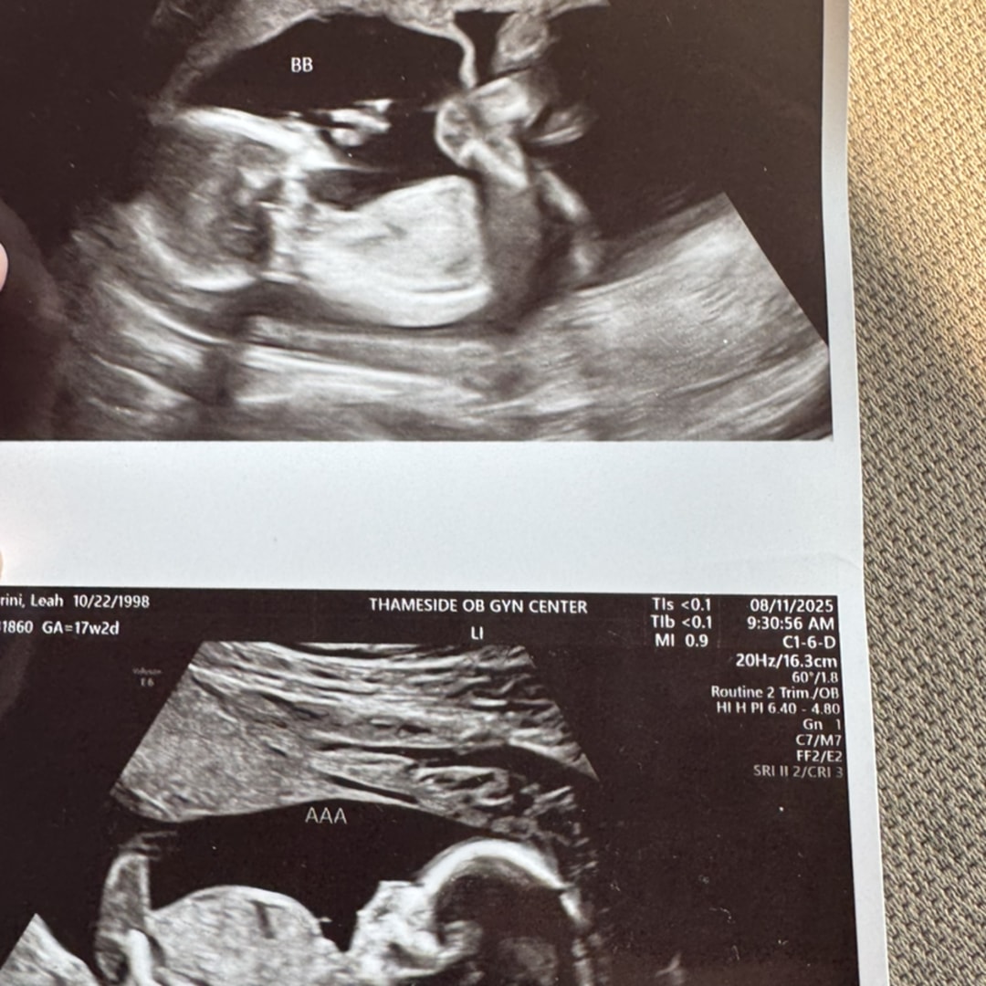 Photo shared by Leah for their Babylist baby registry.