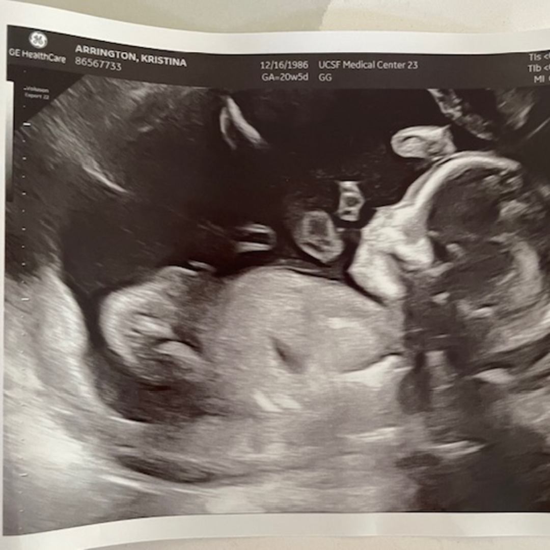 Photo shared by Kindell for their Babylist baby registry.