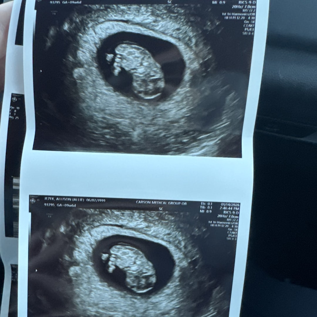 Photo shared by Allison for their Babylist baby registry.