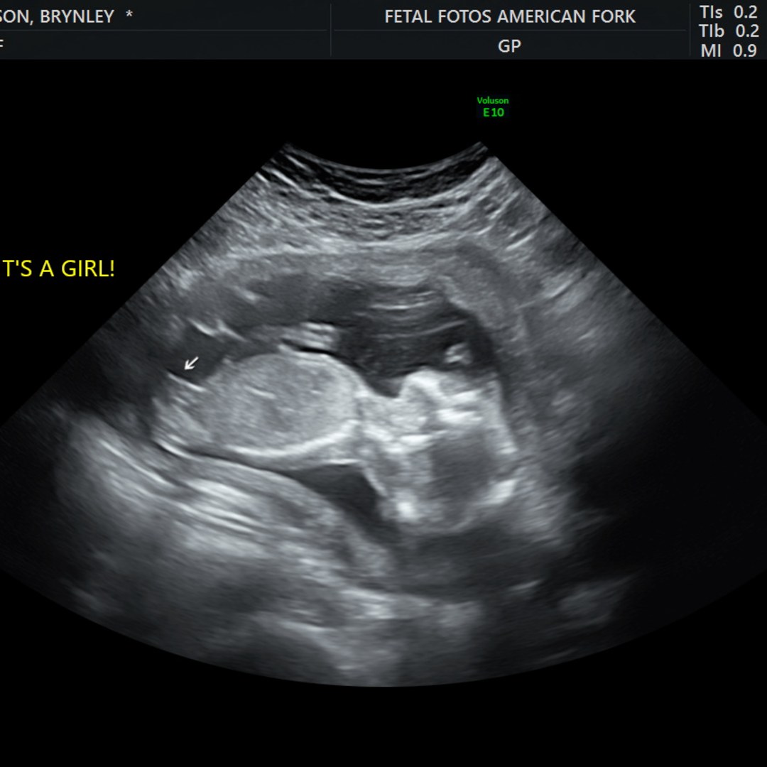 Photo shared by Brynley for their Babylist baby registry.