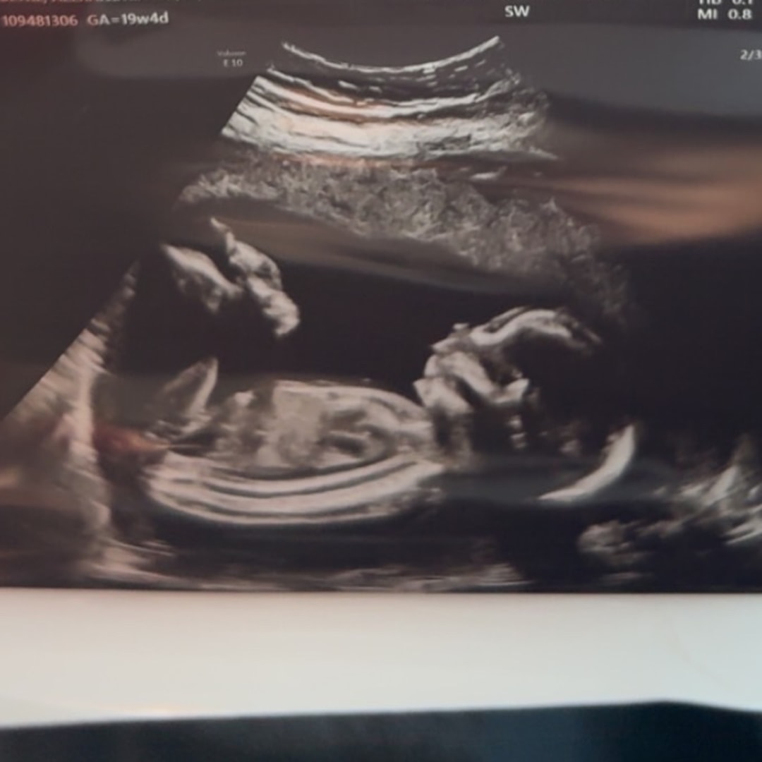 Photo shared by Lexie for their Babylist baby registry.