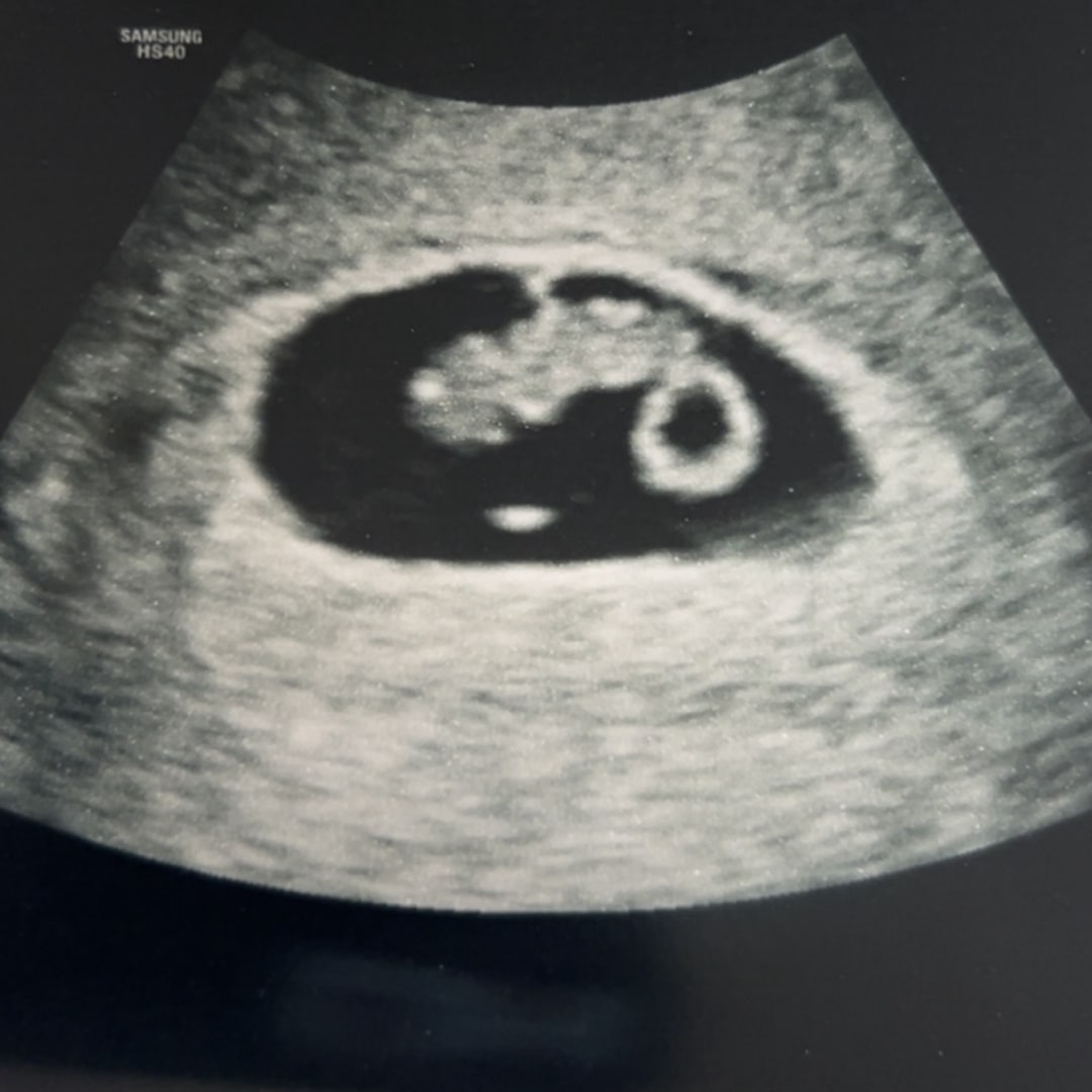 Photo shared by Jessica for their Babylist baby registry.