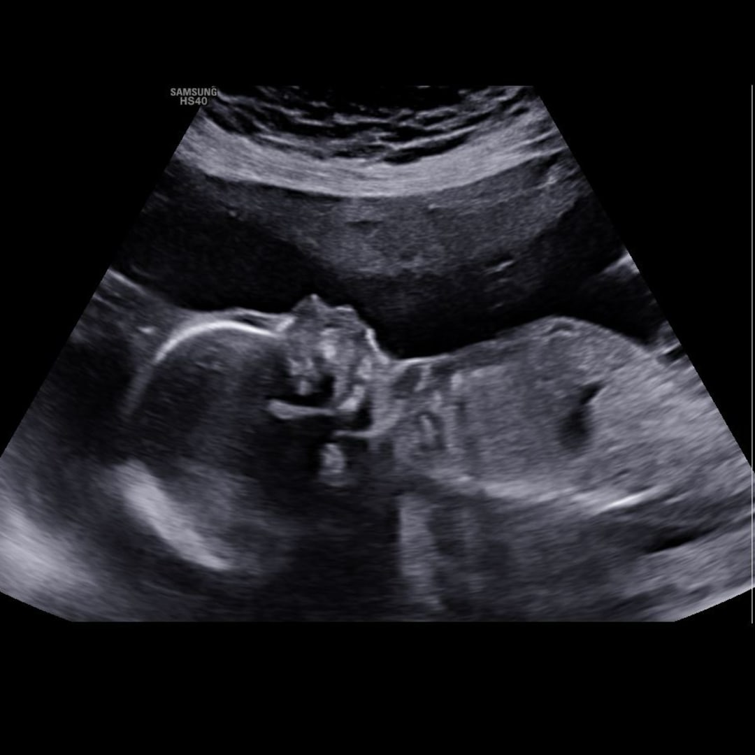 Photo shared by Savannah for their Babylist baby registry.