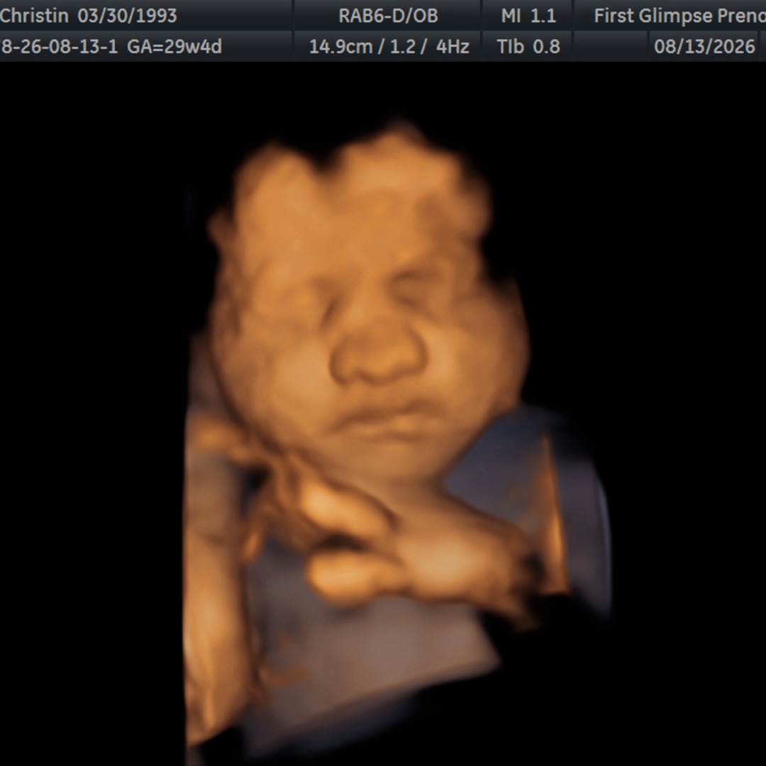 Photo shared by Christin for their Babylist baby registry.