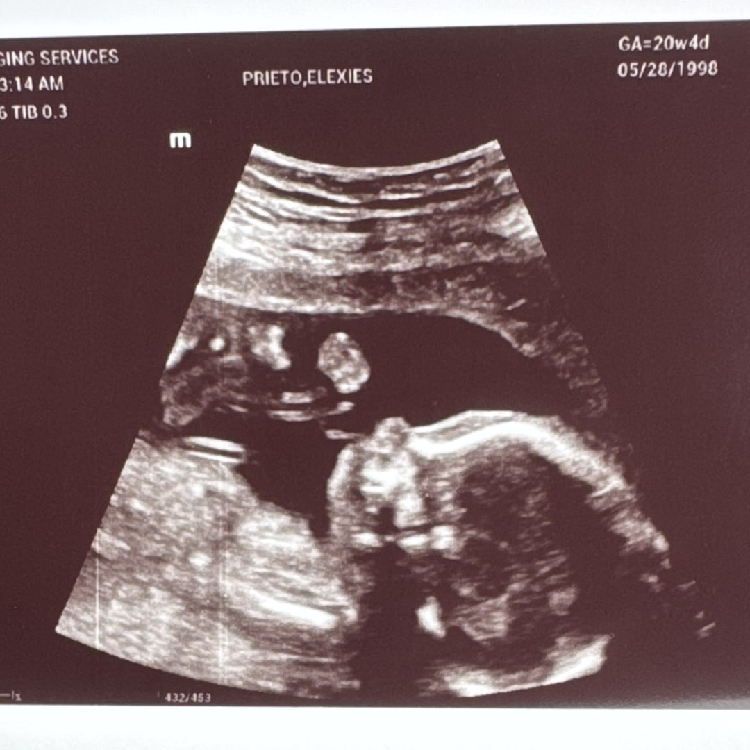 Photo shared by Elexies for their Babylist baby registry.