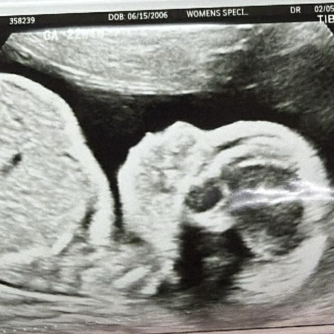 Photo shared by Mia for their Babylist baby registry.