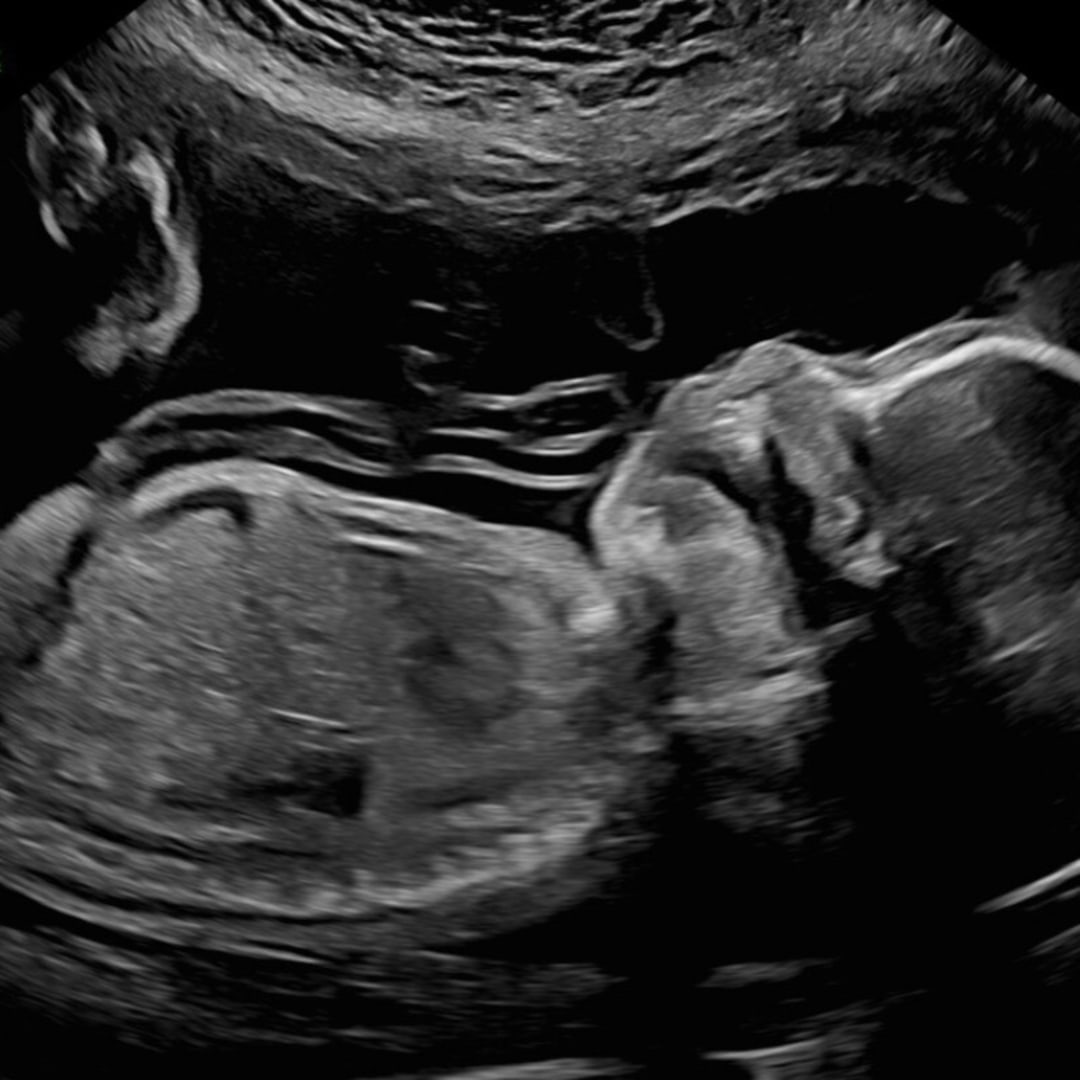 Photo shared by D for their Babylist baby registry.